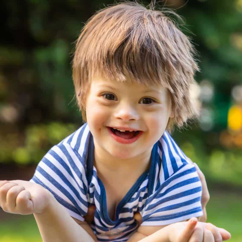 Child with Downs Syndrome